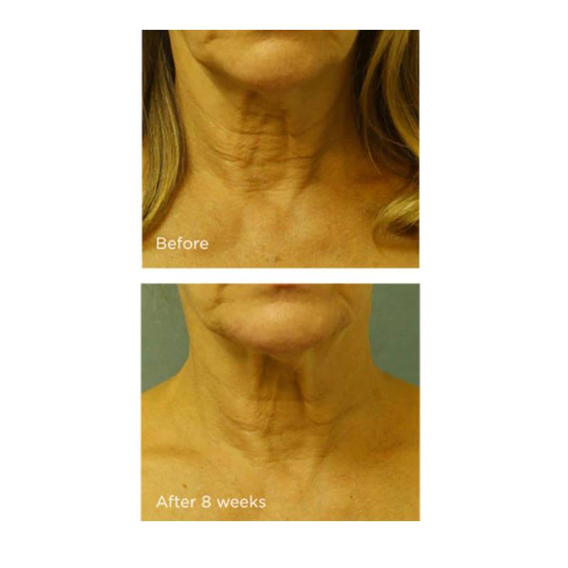 Crema Cold Plasma Plus Cuello y Pecho SPF 25 Perricone MD 30ml.