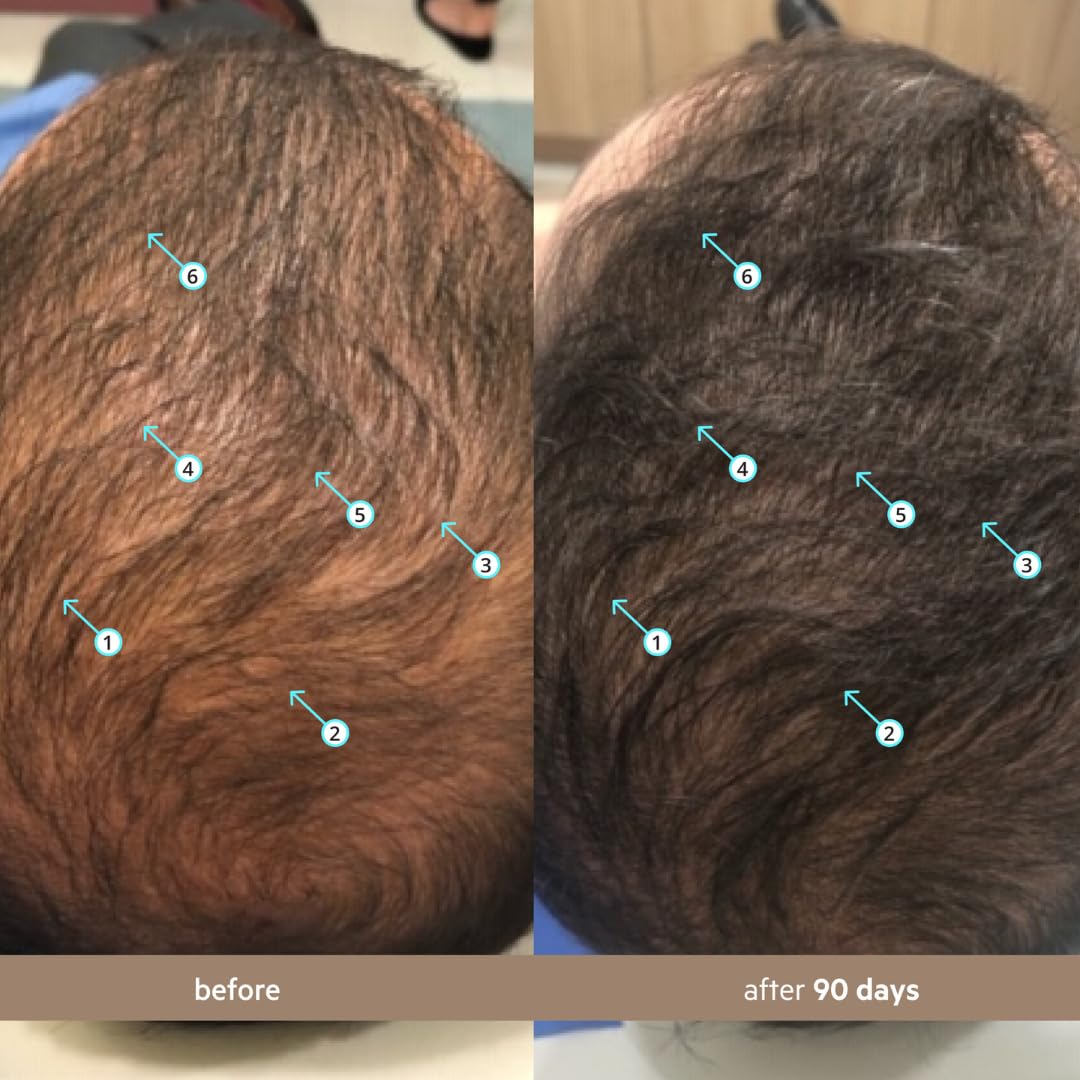 DS Labs Spectral - Suero de densidad de cabello para hombre