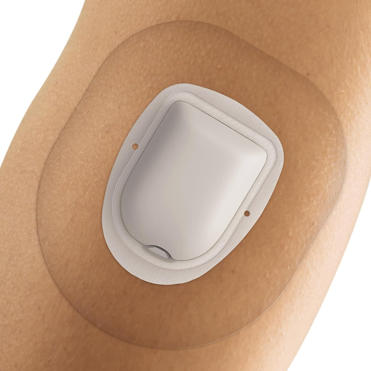 Fixic - Paquete de 25 - Parches Adhesivos - Perfecto para Omnipod