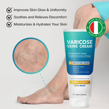 Crema Itlufly Para Venas Varicosas: Alivio Y Eficacia