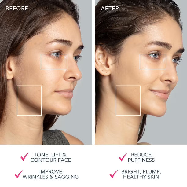 Dispositivo Facial FOREO BEAR™ 2 Advanced Microcurrent