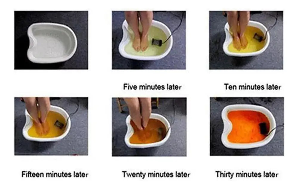 Máquina de Limpieza Iónica para Pies Detox Foot Spa