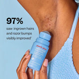 Peach Slices Smoothing Solution 50 ml – Tratamiento para Vellos Encarnados y Granitos por Depilación