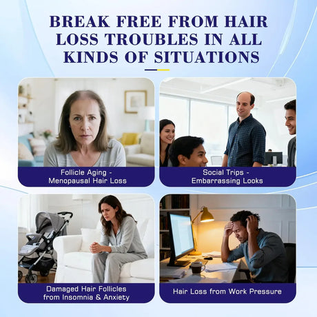 Solución De Pérdida De Cabello En Aerosol Con 5% De Minoxidil