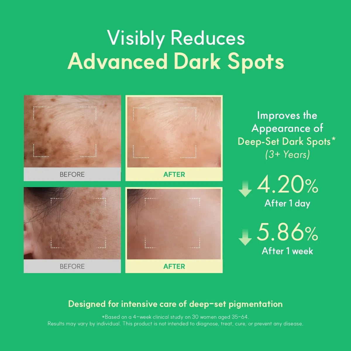 Easydew DW-EGF Melatoning Ampoule Serum 5X 30 ml