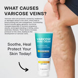 Crema Itlufly Para Venas Varicosas: Alivio Y Eficacia